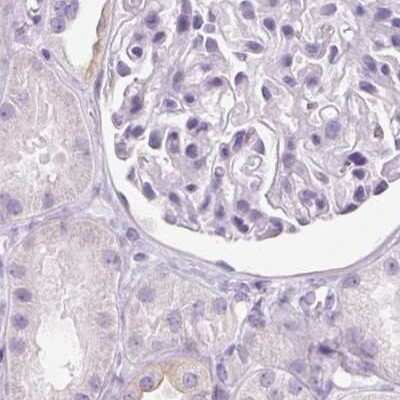 Immunohistochemistry-Paraffin: RPTN Antibody [NBP1-93792]
