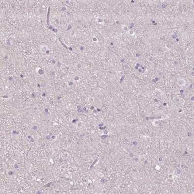 Immunohistochemistry-Paraffin: RPTN Antibody [NBP2-38159]