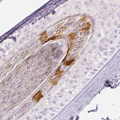 Immunohistochemistry-Paraffin: RPTN Antibody [NBP2-38159]