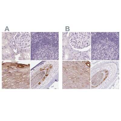 Immunohistochemistry-Paraffin: RPTN Antibody [NBP2-38159]