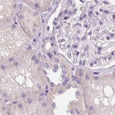 Immunohistochemistry-Paraffin: RPTN Antibody [NBP2-38159]