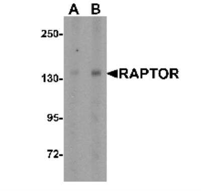 Western Blot: RPTOR AntibodyBSA Free [NBP1-77211]