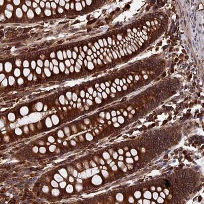 Immunohistochemistry-Paraffin: RPUSD1 Antibody [NBP1-88448]