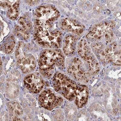 Immunohistochemistry-Paraffin: RPUSD1 Antibody [NBP1-88449]