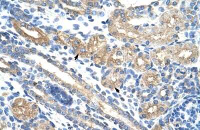 Immunohistochemistry-Paraffin: RPUSD2 Antibody [NBP1-80477]