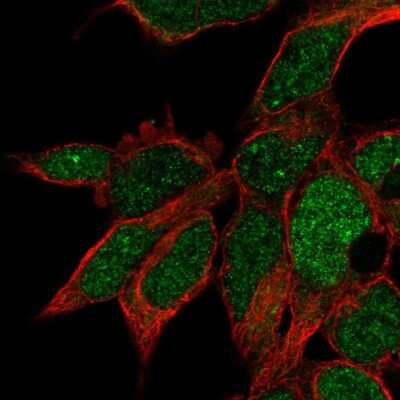 Immunocytochemistry/ Immunofluorescence: RPUSD3 Antibody [NBP2-32685]