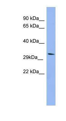 Western Blot: RRAD Antibody [NBP1-58864]
