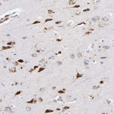 Immunohistochemistry-Paraffin: RRAGB Antibody [NBP1-85801]