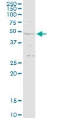 Western Blot: RRAGB Antibody [H00010325-D01P]