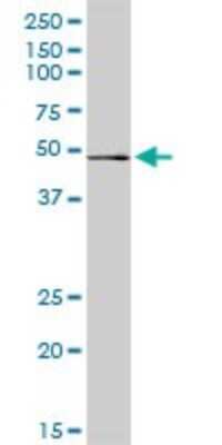 Western Blot: RRAGB Antibody [H00010325-D01P]