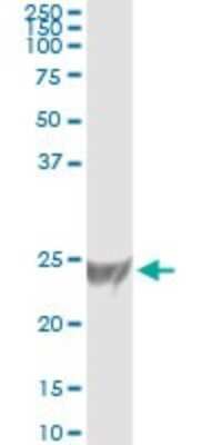 Immunoprecipitation: RRAS Antibody (2E12) [H00006237-M01]
