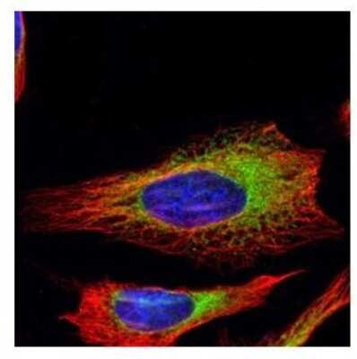 Immunocytochemistry/ Immunofluorescence: RRBP1 Antibody [NBP1-32813]