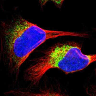Immunocytochemistry/ Immunofluorescence: RRBP1 Antibody [NBP1-83958]