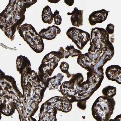Immunohistochemistry-Paraffin: RRBP1 Antibody [NBP1-83958]