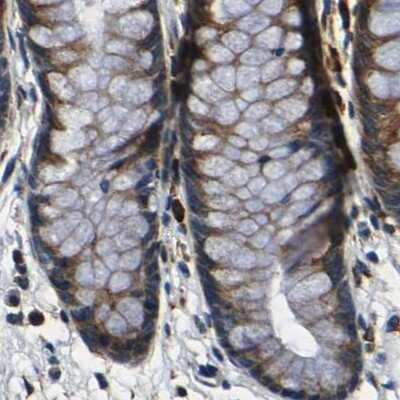 Immunohistochemistry-Paraffin: RRBP1 Antibody [NBP1-83958]