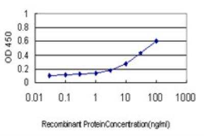 ELISA: RRM1 Antibody (4E4) [H00006240-M03]