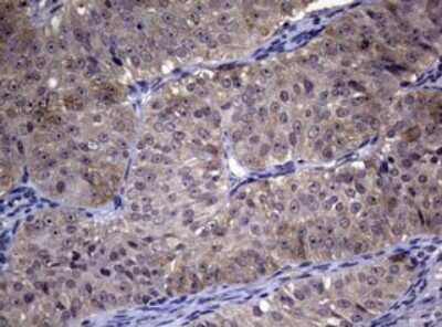 Immunohistochemistry: RRM1 Antibody (OTI5G5) [NBP2-45964]