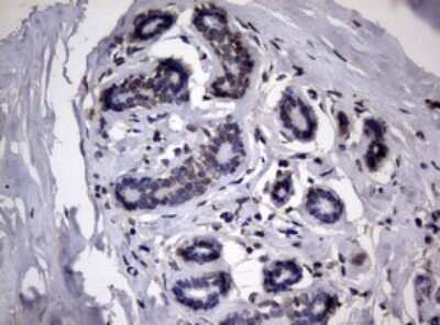 Immunohistochemistry: RRM1 Antibody (OTI5G5) [NBP2-45964]