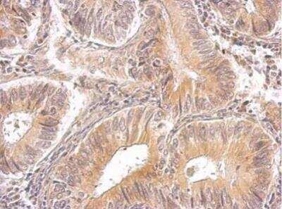 Immunohistochemistry-Paraffin: RRM1 Antibody [NBP2-20231]