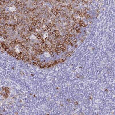 Immunohistochemistry-Paraffin: RRM1 Antibody [NBP2-49252]