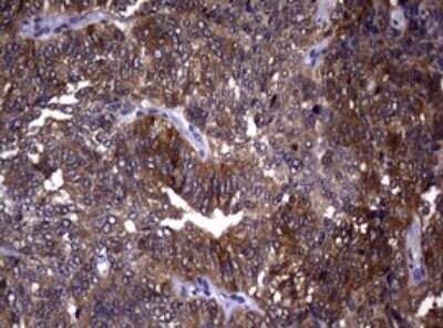 Immunohistochemistry: RRM1 Antibody (OTI5G5) - Azide and BSA Free [NBP2-73947]