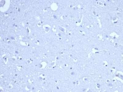 Immunohistochemistry-Paraffin: RRM1 Antibody (RRM1/4372R) [NBP3-07567]
