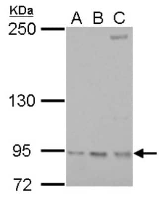 Western Blot: RRM1 Antibody [NBP2-20231]