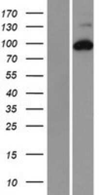 Western Blot: RRM1 Overexpression Lysate [NBP2-08619]