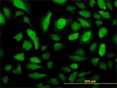 Immunocytochemistry/ Immunofluorescence: RRM2 Antibody (1E1) [H00006241-M01]