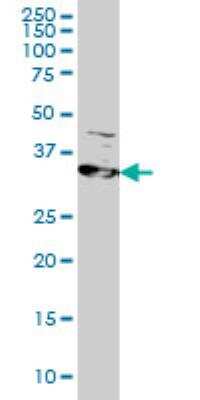 Western Blot: RRM2 Antibody (1E1) [H00006241-M01]
