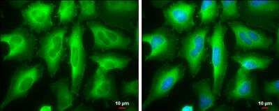 Immunocytochemistry/ Immunofluorescence: RRM2 Antibody [NBP1-31661]