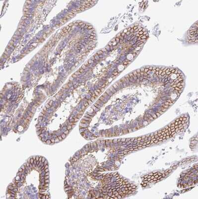 Immunohistochemistry-Paraffin: RRM2 Antibody [NBP2-47294]
