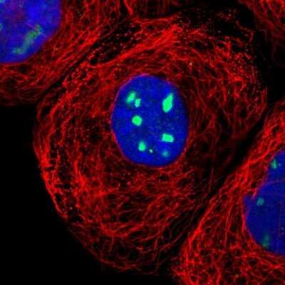 Immunocytochemistry/ Immunofluorescence: RRP1 Antibody [NBP1-85338]