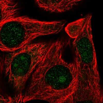 Immunocytochemistry/ Immunofluorescence: RRP12 Antibody [NBP2-55836]