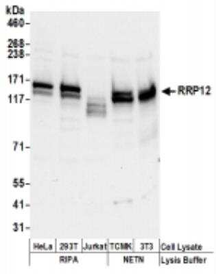 Western Blot: RRP12 Antibody [NBP2-36547]