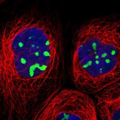 Immunocytochemistry/ Immunofluorescence: RRP1B Antibody [NBP1-81533]
