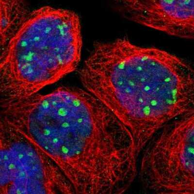 Immunocytochemistry/ Immunofluorescence: RRP1B Antibody [NBP1-81534]