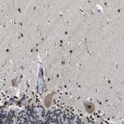 Immunohistochemistry-Paraffin: RRP1B Antibody [NBP1-81533]