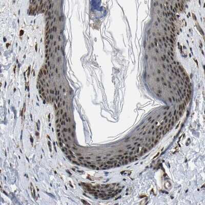 Immunohistochemistry-Paraffin: RRP1B Antibody [NBP1-81533]