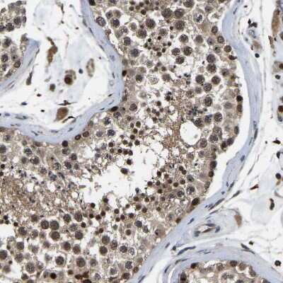 Immunohistochemistry-Paraffin: RRP1B Antibody [NBP1-81533]