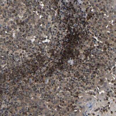 Immunohistochemistry-Paraffin: RRP1B Antibody [NBP1-81533]