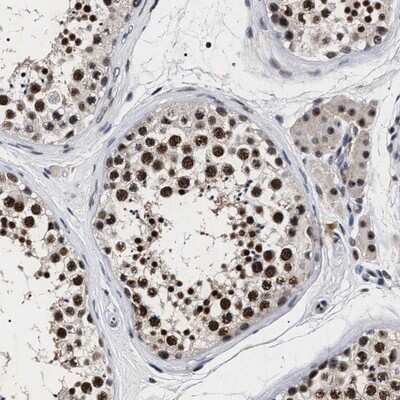 Immunohistochemistry-Paraffin: RRP1B Antibody [NBP1-81534]