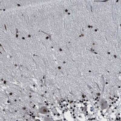 Immunohistochemistry-Paraffin: RRP1B Antibody [NBP1-81534]
