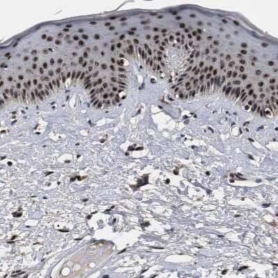 Immunohistochemistry-Paraffin: RRP1B Antibody [NBP1-81534]