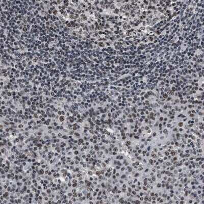 Immunohistochemistry-Paraffin: RRP1B Antibody [NBP1-81534]
