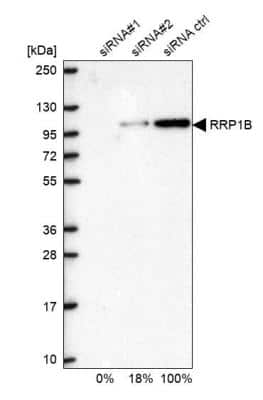 Western Blot: RRP1B Antibody [NBP1-81533]