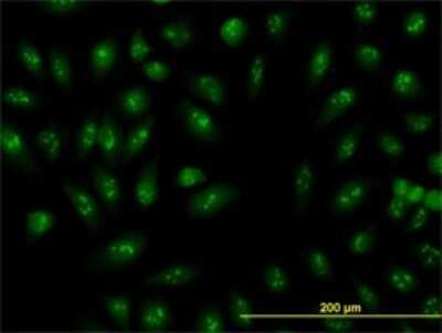 Immunocytochemistry/ Immunofluorescence: RRP9 Antibody (1E8) [H00009136-M01]