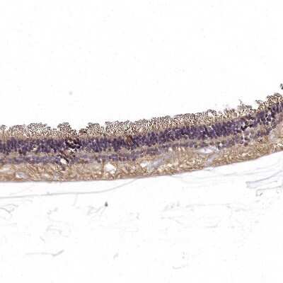 Immunohistochemistry-Paraffin: RS1 Antibody [NBP2-56487]