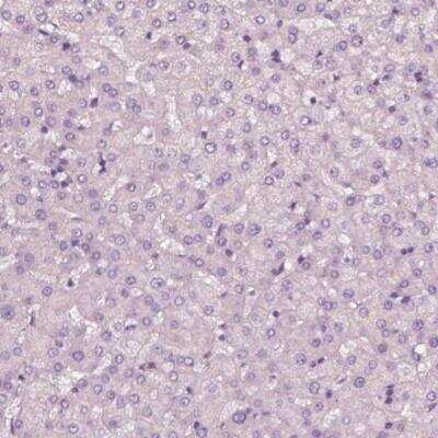 Immunohistochemistry-Paraffin: RS1 Antibody [NBP2-56487]