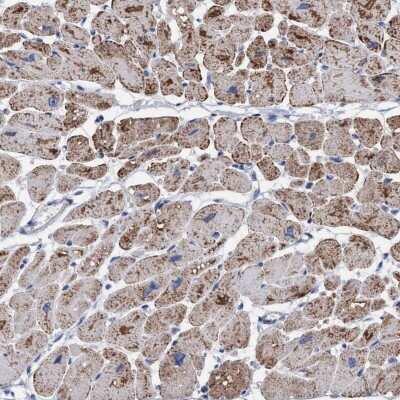 Immunohistochemistry-Paraffin: RSAD1 Antibody [NBP1-83772]